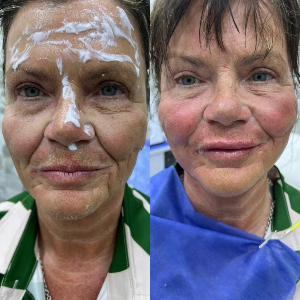 نضارة وعناية بالوجه